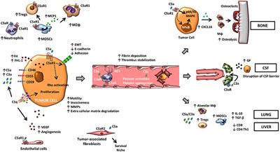 Complement in Metastasis: A Comp in the Camp